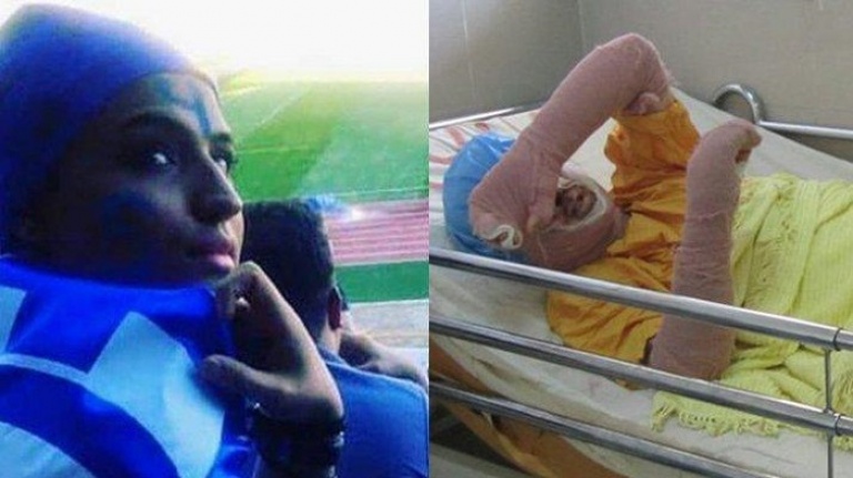 Genç kadın maç izlediği için hapis cezasına çarptırıldı! Kendini yaktı